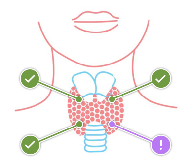 Hyperparathyroid Atlanta Diagram